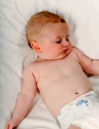 Cot Death Sudden Infant Death Syndrome
