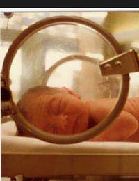 Baby Born Premature Prematurely Birth