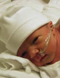 Premature Premature Baby Babies Special